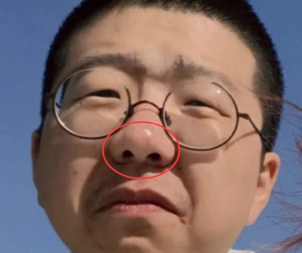 高度近视的人把眼镜"偷摘"下来,会发生什么?这3点变化