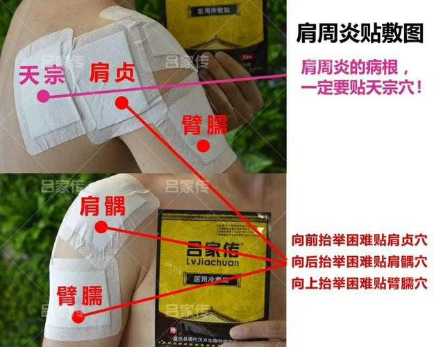 吕家传膏药的正确贴敷法