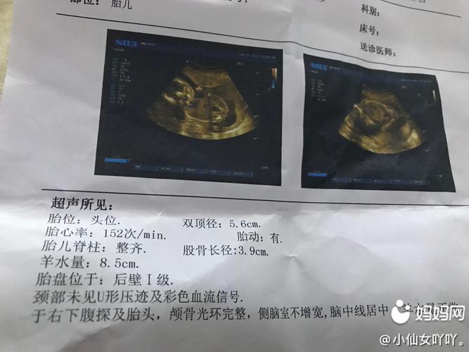 今天彩超检查,医生说检查的周数22 5,现在怀孕5个半月左右,医生说羊水