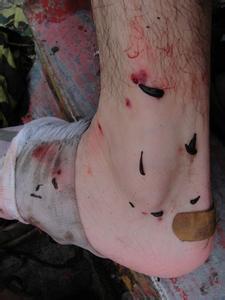 会吸血的水蛏(蚂蝗),多生活在静水沼泽中