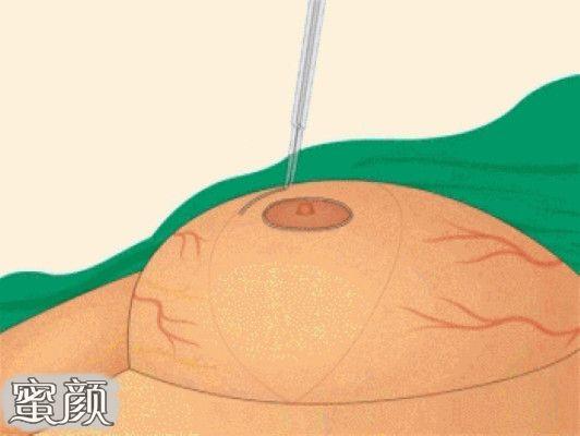 从世界上最大的胸杯波霸的生活中我们可以看到,其