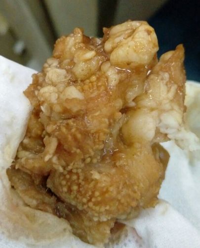 求鉴定是米牛肉还是脂肪粒,给卫生防疫站看了说没事,但还是很担心