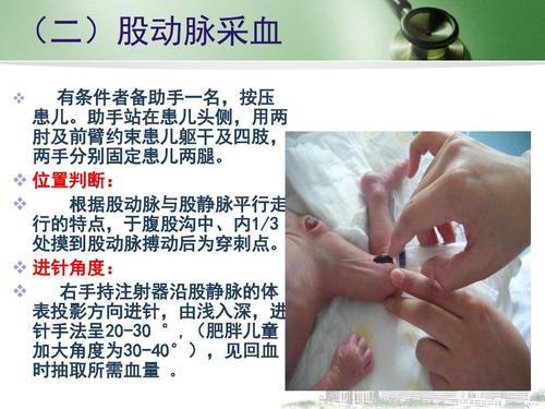 位置判断:   根据股动脉与股静脉平行走 行的特点,于腹股沟中,内1