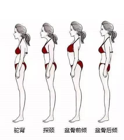 骨盆前倾被一姐说到嘴都瓢了,所以这周给仙_圈子-新氧美容整形