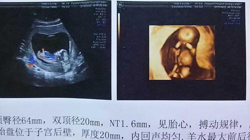 nt照片,看着很可爱