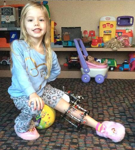 为了女儿的未来,拒绝截肢建议的父母,让女儿忍痛左腿增长10厘米