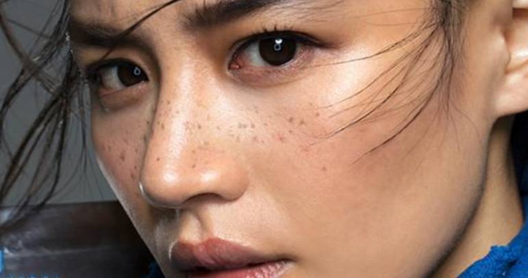 图片源自:《将军在上》 大胆地把这种瑕疵画在脸上的雀斑妆,超迷人!