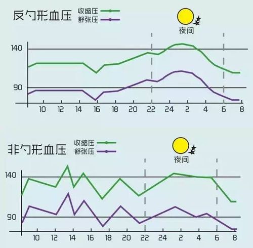知识图解:高血压是怎么回事?