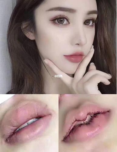 m唇,微笑唇_女神降临_美妆_医美整形