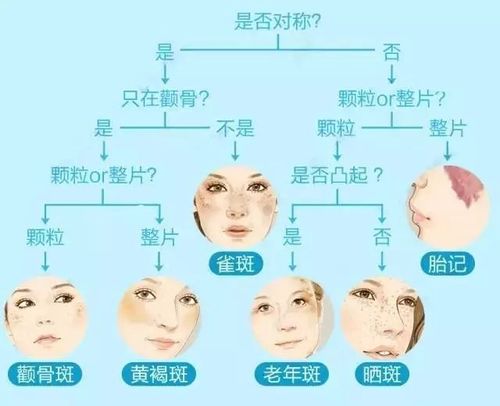 脸上最容易长斑的八种女人!她们到底做了什么,让斑层出不穷?