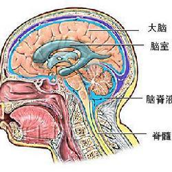 脑脊液漏的介绍