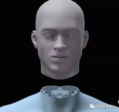 世界首例换头手术在中国成功!主刀医生中国人,换