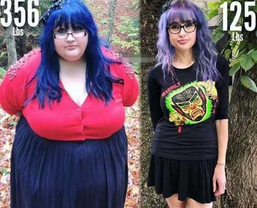 330斤胖女孩4年减至125斤