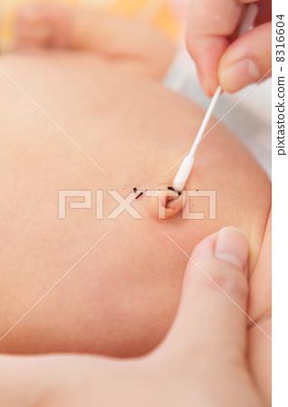 照片 肚脐 改善 消毒 首页 照片 人物 儿童 幼儿/幼稚园儿童 肚脐