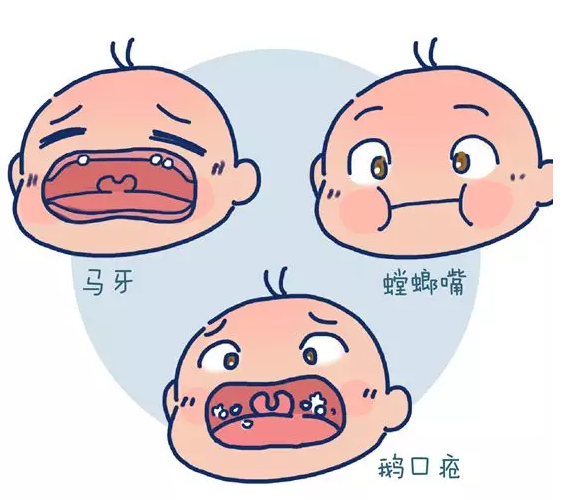 需要给新生宝宝清洗口腔吗 新生宝宝每天口腔都要清理