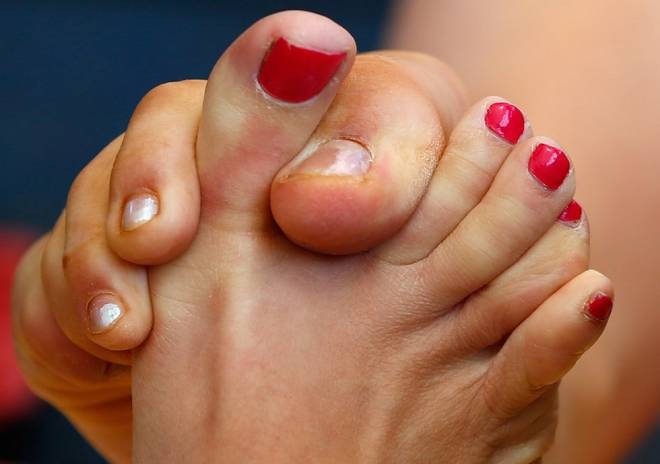 实拍英国"掰脚趾"大赛,脚对脚的较量(1)