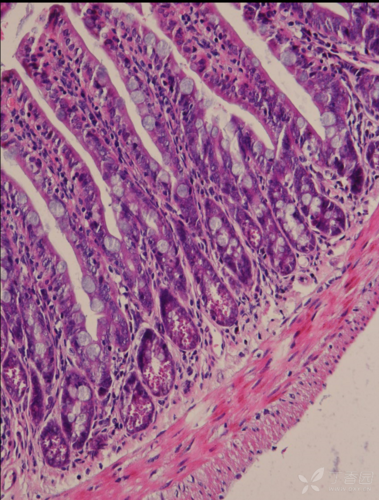 【求助】求大神帮忙,小鼠回肠段he染色的病理学分析