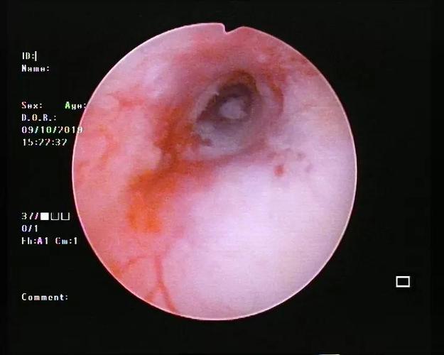 即日起,饱受宫腔问题困扰的患者可预约"宫腔镜男神"郑杰教授手术啦!
