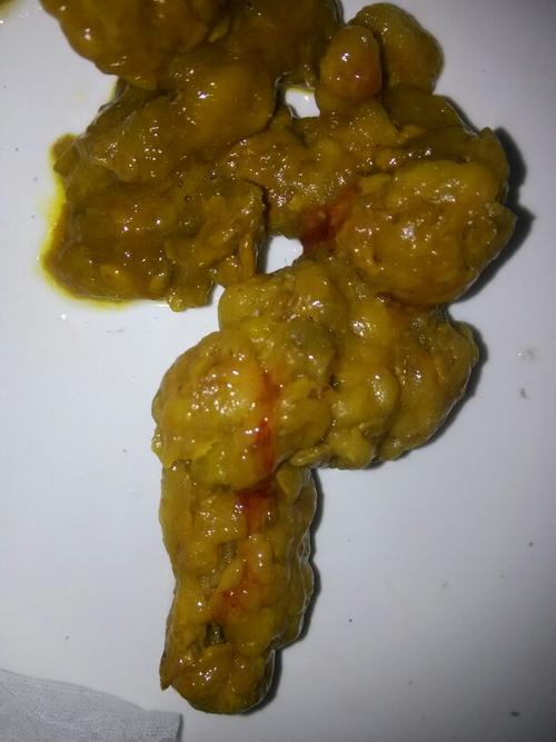 今天大便几次都有血,肛门镜看了两次,第一次医生说痔疮和一点点肛裂