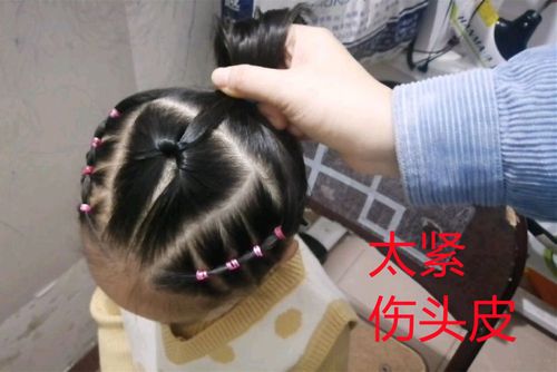 幼儿园老师绑头发太紧,宝妈心疼孩子,私聊得回复:剪短发就好了