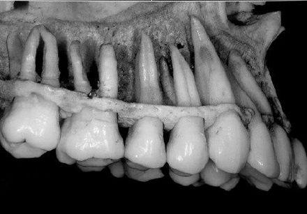 原来牙根不是长在肉里的!