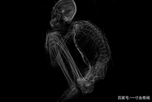 疑似外星生物干尸的x光片