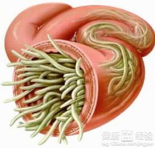 诺氟沙星能治疗肠道蛔虫病吗