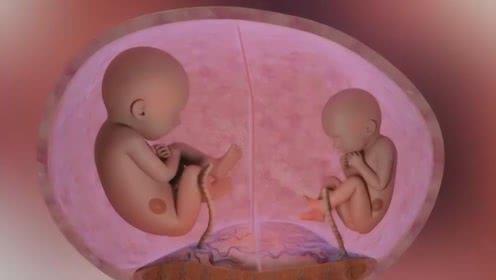 双胞胎在妈妈肚子里是怎么样的?