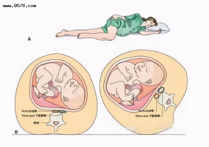孕妇左侧卧的益处,漂亮妈妈可以试试