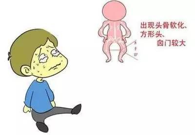 佝偻病活动期分为 早期, 激期, 恢复期, 后遗症期.