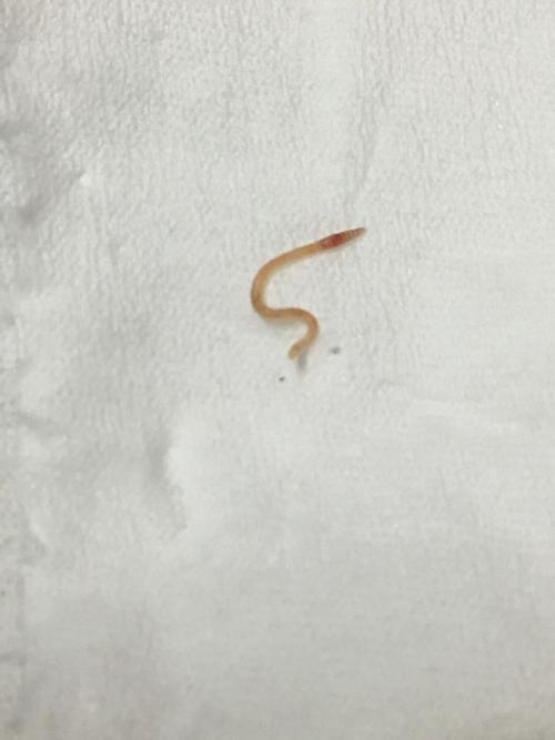 是蚯蚓幼虫?寄生虫?有没有这