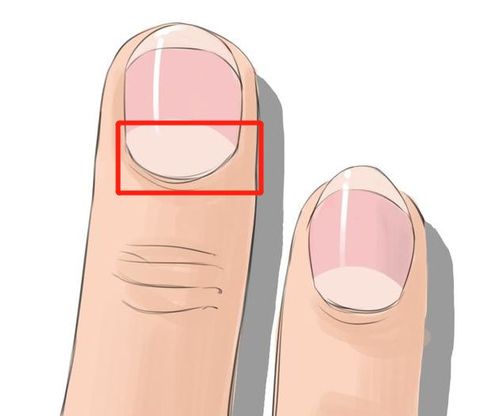 出现的白色弧形,叫「甲半月」或「半月痕」,其实是指甲生长过程中的
