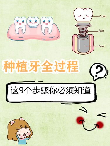 种植牙全过程这9个步骤你必须知道