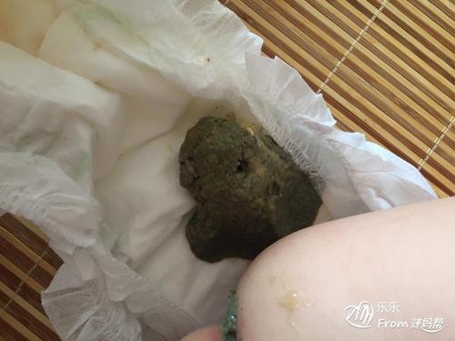 这几天宝宝一直拉这样的臭臭,都是喝完奶粉就拉,昨天晚上