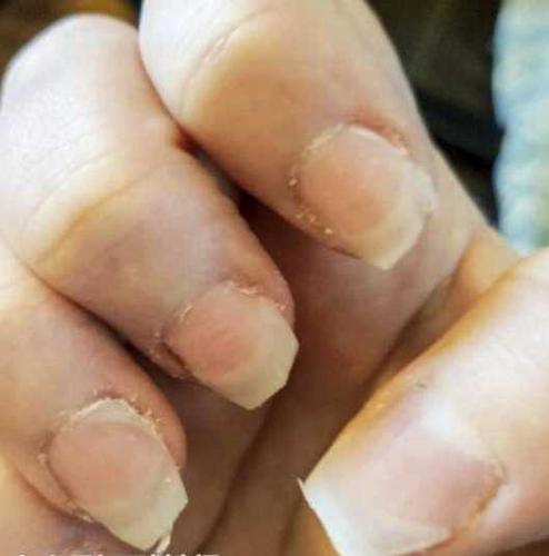 美甲后指甲受损图片 短指甲美甲图片大全 简约