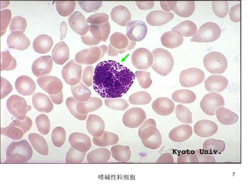 嗜碱性粒细胞