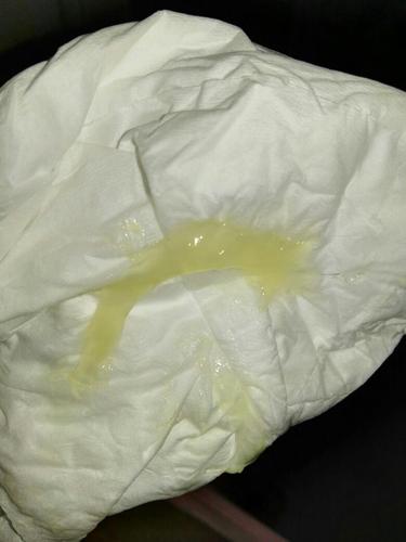 早上我果冻状分泌物,求助有经验的宝妈看看宝宝是不是