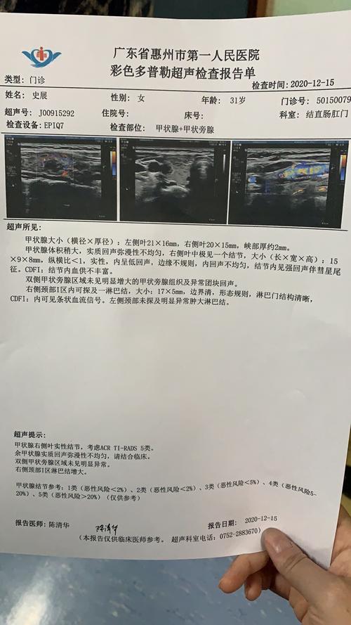 31岁,我得了甲状腺癌(全方位分享)