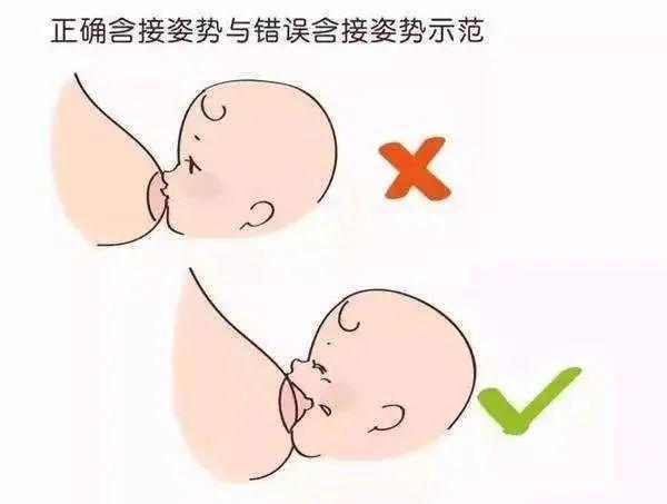 产后胸部下垂是因为母乳喂养?真正下垂的原因只有这一