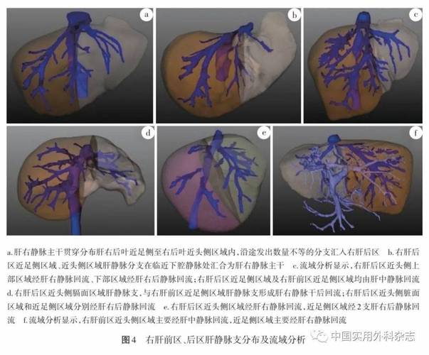 论著右肝段区域划分新认识的解剖学依据研究附110例人右肝三维数字