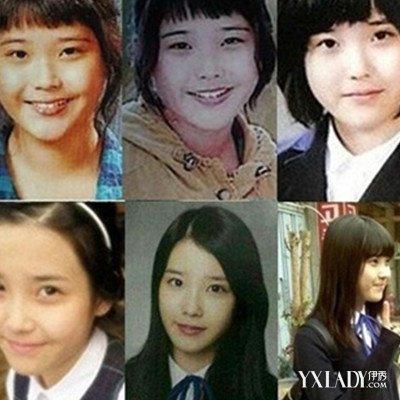 【图】iu李智恩出道前照片 揭秘iu是否整容