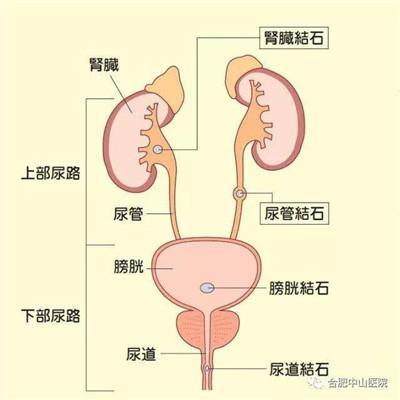 经尿道肾镜下气压弹道碎石术治疗成人膀胱结石