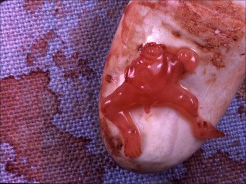 阴道掉下肉块,这是流产了吗