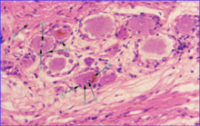 合成束,把许多大而圆的脊神经节细胞分隔成若干个群.