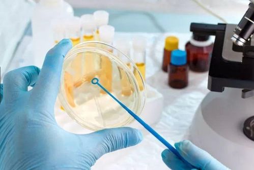 微生物标本采集系列之—— 尿液标本的采集