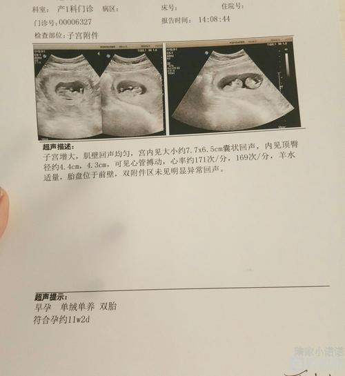 单绒单羊,宝贝们要加油一起长大呀,你老妈