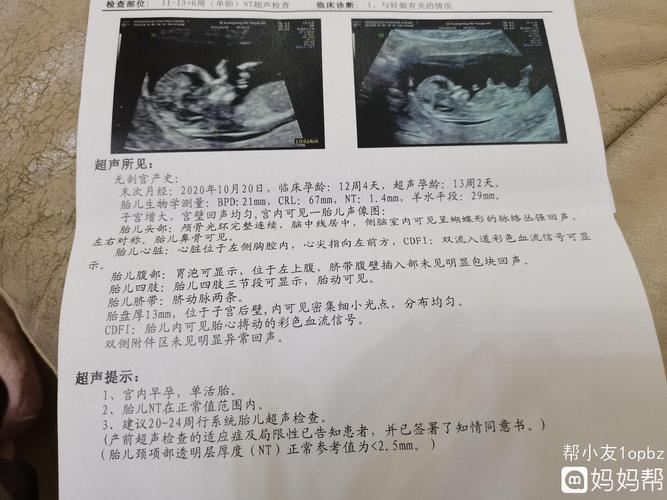 13周做的b超是女儿还有没有翻盘的可能