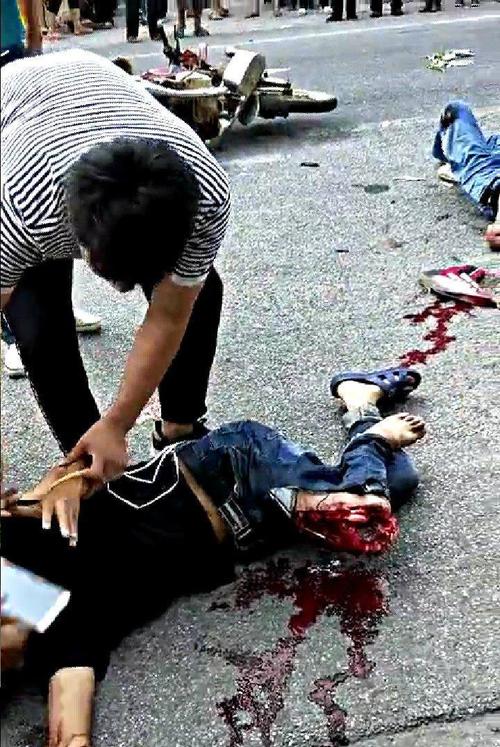 摩托车撞上装鸡货车,大腿被撞成豆腐渣,美女护士现场急救