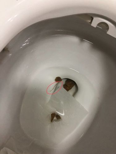 大概有10cm不会动,是不是蛔虫?四