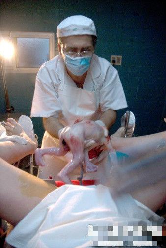 产妇生孩子的6种姿势(图)